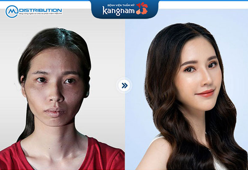 don-thai-duong-tai-kangnam-gia-bao-nhieu-cmcdistribution