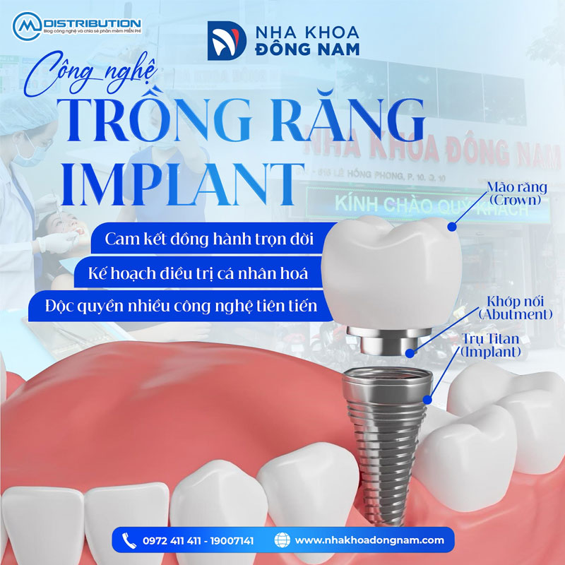 cac-yeu-to-anh-huong-den-chi-phi-trong-rang-implant-1-cmcdistribution
